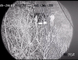 Máy ảnh hồng ngoại tầm nhìn ban đêm bằng laser tích hợp với đèn chiếu sáng laser Nir
